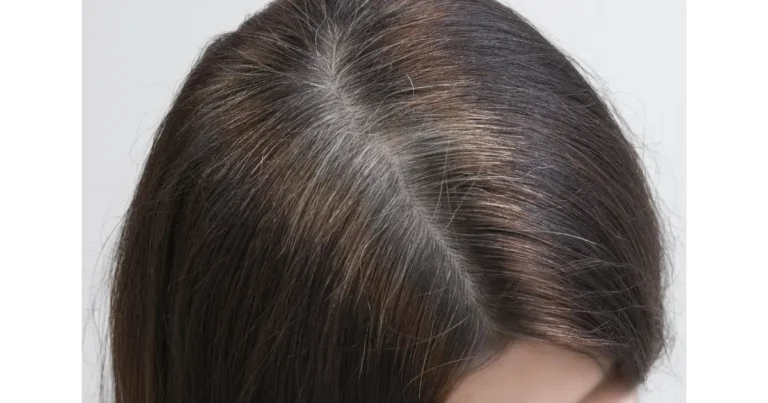 Home Remedies for Gray Hair: How to Prevent It With 2 Ingredients